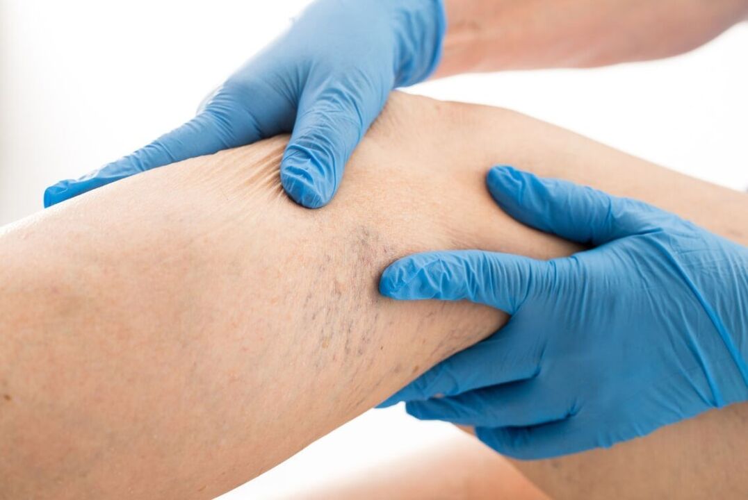 Cartin klinikoko barizeak